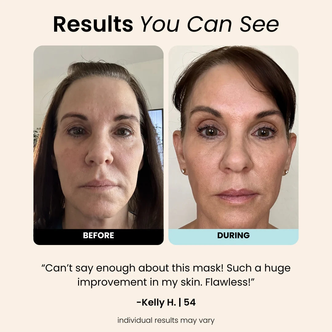 Lumilys - Regenmask 2.0